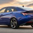 2021 Hyundai Elantra N Line – 1.6T, 201 hp, 264 Nm!