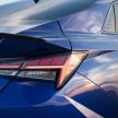 2021 Hyundai Elantra N Line – 1.6T, 201 hp, 264 Nm!