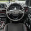 GALLERY: Hyundai Kona 2.0 MPI Mid – first photos of local-spec naturally-aspirated variant, 149 PS/179 Nm