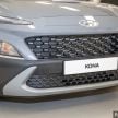 Hyundai Kona facelift launched in Malaysia – 2.0L NA CVT only, Active now with AEB, RM120k to RM137k